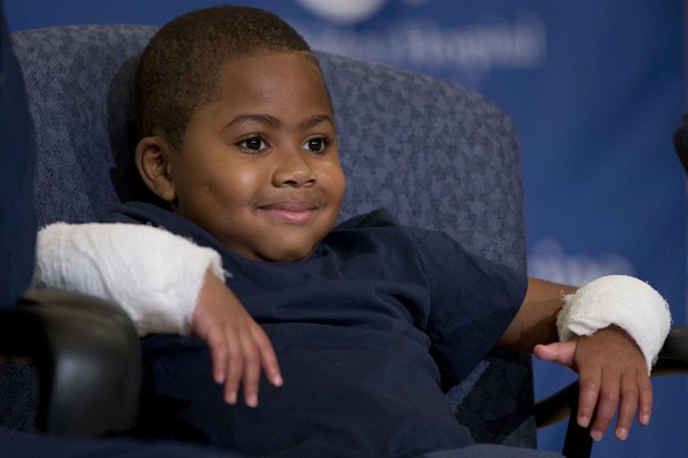 Garoto de 8 anos recebe transplante duplo de mãos nos Estados Unidos