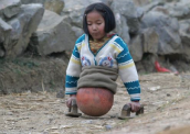 A menina que usava bola de basquete no lugar das pernas 172-x-122