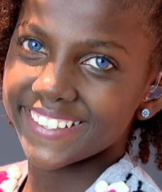 Com deficiência, menina dos olhos cor de safira ganha uma esperança